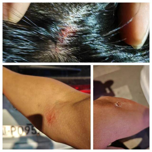 皇冠信用网怎么代理
_向前一横!辽P0952警皇冠信用网怎么代理
,救下5个孩子