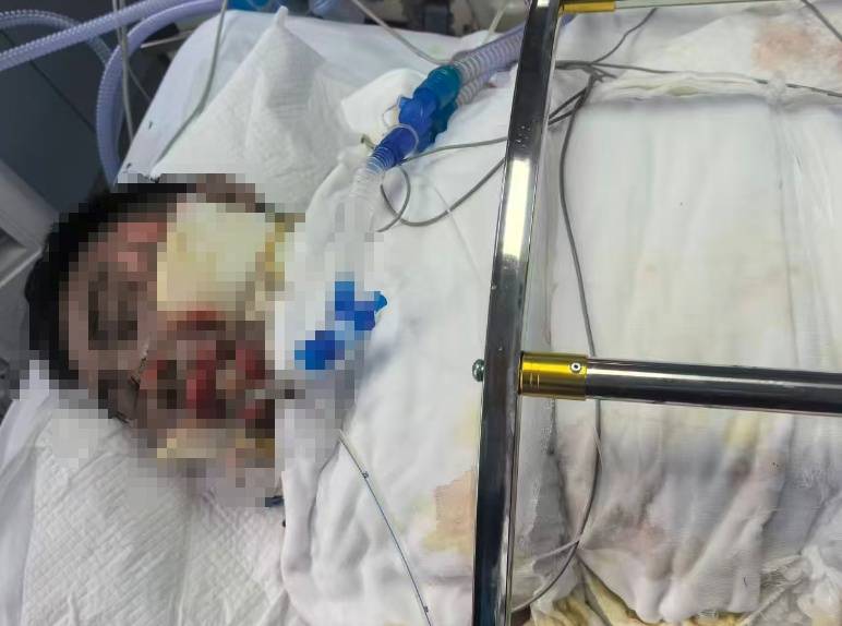 皇冠官网_滚烫的水皇冠官网,从头流到脚!今晚洗澡前紧急提醒!