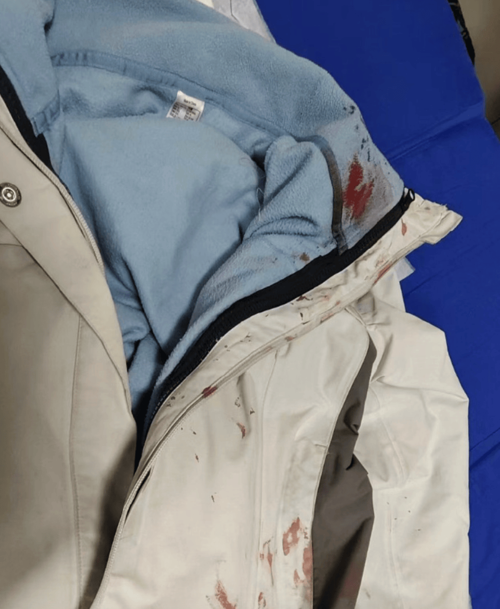 正版皇冠信用网代理_河南一男子街头挥刀乱刺正版皇冠信用网代理,被休假女警一脚踢落凶器!女警面部缝合30余针,手套被血浸透